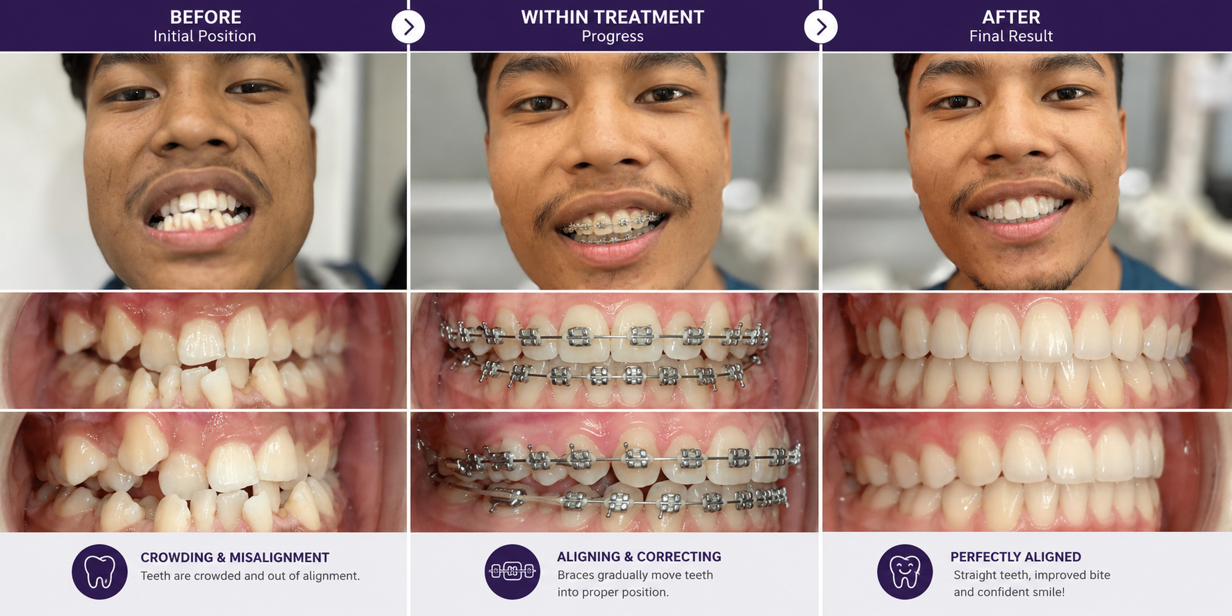 Braces & Orthodontics